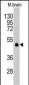 PI4K2A  (PI4K II) Antibody (N-term)